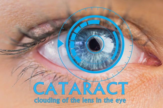 eyesight-cataract-reasons-symptoms